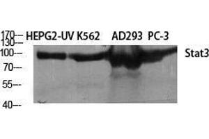 Western Blot (WB) analysis of different cells using Stat3 Polyclonal Antibody. (STAT3 Antikörper  (Tyr1222))