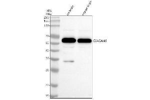 Western blot analysis of CEACAM6 using anti-CEACAM6 antibody (ABIN7604409).
