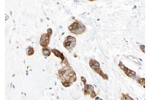 ABIN6268773 at 1/100 staining human breast tissue sections by IHC-P. (KRT14 Antikörper  (N-Term))