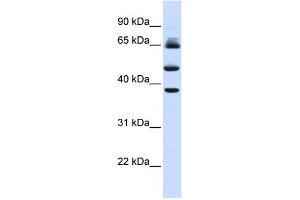 WB Suggested Anti-FBXL3 Antibody Titration:  0.