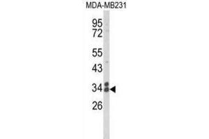Western Blotting (WB) image for anti-Clathrin, Light Chain A (CLTA) antibody (ABIN3004002) (CLTA Antikörper)