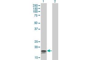 Western Blot analysis of IFNA2 expression in transfected 293T cell line by IFNA2 monoclonal antibody (M33), clone 4H3. (IFNA2 Antikörper  (AA 24-188))