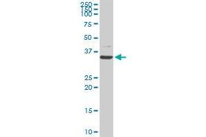 CDK4 monoclonal antibody (M07), clone 8C3. (CDK4 Antikörper  (AA 211-303))