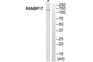 Western blot analysis of extracts from Jurkat cells, using RANBP17 antibody. (RANBP17 Antikörper  (N-Term))