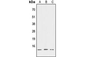 Western blot analysis of ATP6V1G3 expression in HEK293T (A), NIH3T3 (B), PC12 (C) whole cell lysates. (ATP6V1G3i Antikörper  (Center))