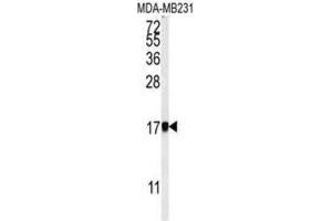 Western Blotting (WB) image for anti-Adaptor Related Protein Complex 1 sigma 1 (AP1S1) antibody (ABIN3002203) (AP1S1 Antikörper)