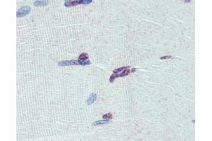 PRDM9 antibody was used for immunohistochemistry at a concentration of 4-8 ug/ml. (PRDM9 Antikörper  (Middle Region))