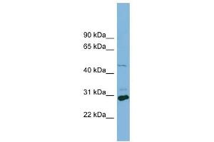 SLC16A1 antibody used at 1 ug/ml to detect target protein. (SLC16A1 Antikörper)