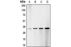 Western blot analysis of CDK1/2/3 (pT14) expression in HT29 hydroxyurea-treated (A), HeLa (B), NIH3T3 (C), A431 (D) whole cell lysates. (CDK1/2/3 (N-Term), (pSer14) Antikörper)