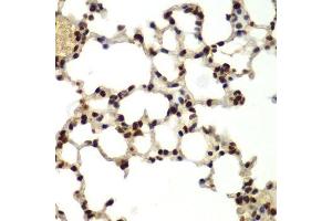 Immunohistochemistry (Paraffin-embedded Sections) (IHC (p)) image for anti-DEAD (Asp-Glu-Ala-Asp) Box Polypeptide 5 (DDX5) (AA 1-614) antibody (ABIN6139505)