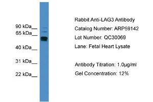 WB Suggested Anti-LAG3  Antibody Titration: 0. (LAG3 Antikörper  (C-Term))