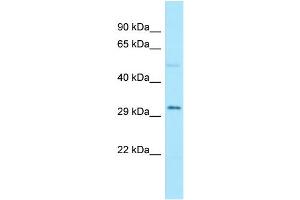 Western Blotting (WB) image for anti-Alport Syndrome, Mental Retardation, Midface Hypoplasia and Elliptocytosis Chromosomal Region Gene 1 (AMMECR1) (C-Term) antibody (ABIN2789119)