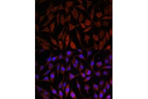 Immunofluorescence analysis of L929 cells using NEDD4L antibody (ABIN6132407, ABIN6144504, ABIN6144505 and ABIN6224109) at dilution of 1:100. (NEDD4-2 Antikörper  (AA 836-955))