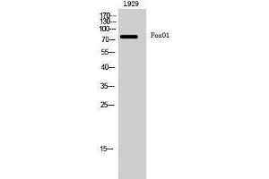 Western Blotting (WB) image for anti-Forkhead Box O1 (FOXO1) (Ser380) antibody (ABIN3175131) (FOXO1 Antikörper  (Ser380))