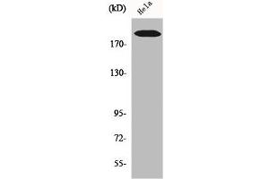 Western Blot analysis of Hela cells using COL5A1 Polyclonal Antibody (COL5A1 Antikörper  (Internal Region))