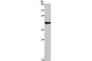 Western Blotting (WB) image for anti-Transcription Factor Dp-1 (TFDP1) antibody (ABIN5544342) (DP1 Antikörper)