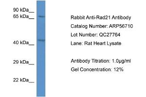 Western Blotting (WB) image for anti-RAD21 Homolog (RAD21) (C-Term) antibody (ABIN2786858) (RAD21 Antikörper  (C-Term))