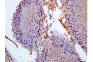 Formalin-fixed and paraffin embedded rat testis labeled with Anti-phospho-BCAR1(Tyr410) Polyclonal Antibody, Unconjugated (ABIN715991) at 1:200 followed by conjugation to the secondary antibody and DAB staining (BCAR1 Antikörper  (pTyr410))