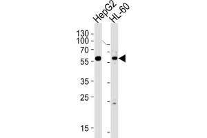 Western Blotting (WB) image for anti-Fanconi Anemia, Complementation Group C (FANCC) antibody (ABIN3004210) (FANCC Antikörper)