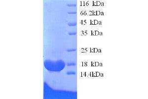 Butyrylcholinesterase (BCHE) (AA 1-141), (full length) protein (His tag)