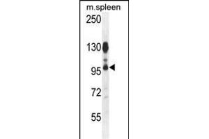 AC Antibody (N-term) 1134a western blot analysis in mouse spleen tissue lysates (35 μg/lane). (ACAP1 Antikörper  (N-Term))