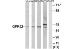 Western blot analysis of extracts from COLO/HuvEc/HeLa/HepG2 cells, using GPR52 Antibody.