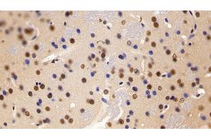 Detection of LXRb in Mouse Cerebrum Tissue using Polyclonal Antibody to Liver X Receptor Beta (LXRb)