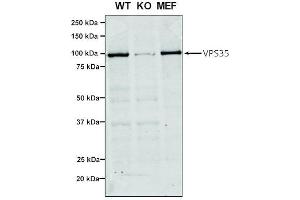 Western Blot analysis of Human, Mouse A549, MEF showing detection of VPS35 protein using Mouse Anti-VPS35 Monoclonal Antibody, Clone 7E4 (ABIN6932910). (VPS35 Antikörper  (Atto 488))