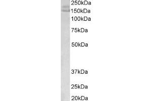 ABIN5539465(0. (AKAP12 Antikörper  (C-Term))
