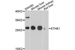 Western blot analysis of extracts of various cell lines, using ETHE1 antibody (ABIN4903613) at 1:1000 dilution. (ETHE1 Antikörper)