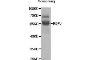 Western Blotting (WB) image for anti-Recombination Signal Binding Protein For Immunoglobulin kappa J Region (RBPJ) antibody (ABIN1876876)