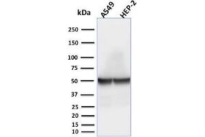 Western Blot Analysis of A549 and HEP-2 cell lysates using Cytokeratin 18 Mouse Monoclonal Antibody (rKRT18/1190). (Rekombinanter Cytokeratin 18 Antikörper)