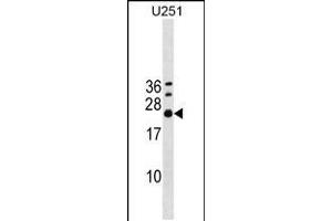 Western blot analysis in U251 cell line lysates (35ug/lane). (EXOSC4 Antikörper  (AA 69-96))