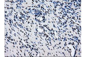 Immunohistochemical staining of paraffin-embedded colon tissue using anti-HDAC10mouse monoclonal antibody. (HDAC10 Antikörper)