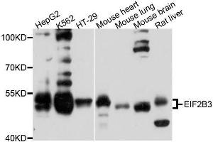 Western blot analysis of extracts of various cell lines, using EIF2B3 antibody. (EIF2B3 Antikörper  (AA 1-270))