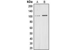 Western blot analysis of CHD1L expression in HeLa (A), HEK293T (B) whole cell lysates.