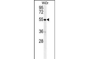 Western blot analysis in WiDr cell line lysates (35ug/lane). (C4BPA Antikörper  (C-Term))