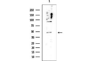 Western blot analysis of lysates from HUVEC cells, using Desmin Mouse Monoclonal Antibody at 1/1000 dilution.