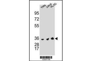 TYSY Antibody (C-term) A western blot analysis in Hela,Jurkat and HL-60 cell line lysates (35 μg/lane). (TYMS Antikörper  (C-Term))