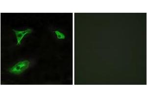 Immunofluorescence analysis of HeLa cells, using GPR116 Antibody. (G Protein-Coupled Receptor 116 Antikörper  (AA 11-60))