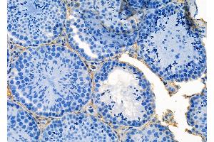 ABIN6264958 and ABIN6273159 at 1/100 staining Mouse testis tissue by IHC-P. (SEC24A Antikörper  (Internal Region))