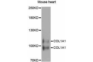 Western blot analysis of extracts of mouse heart, using COL1A1 antibody.