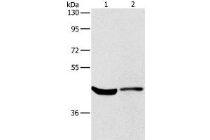 Western Blot analysis of Hela cell and Mouse kidney tissue using KCNA7 Polyclonal Antibody at dilution of 1:550 (KCNA7 Antikörper)