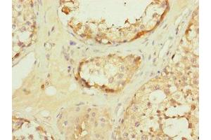 Immunohistochemistry of paraffin-embedded human testis tissue using ABIN7159917 at dilution of 1:100 (TOMM34 Antikörper  (AA 1-309))