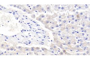 Detection of LTF in Canine Liver Tissue using Polyclonal Antibody to Lactoferrin (LTF) (Lactoferrin Antikörper  (AA 28-351))