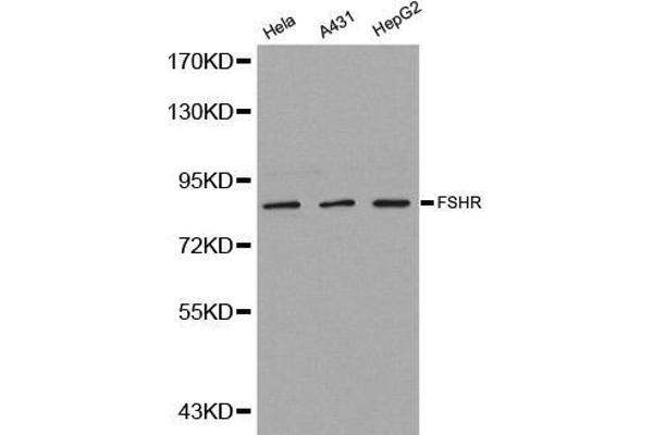 FSHR 抗体  (AA 631-695)