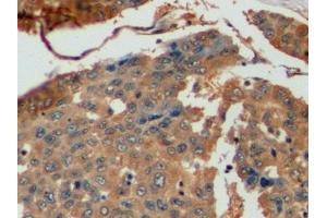 Immunohistochemistry (IHC) image for anti-Thymidylate Synthetase (TYMS) (AA 36-313) antibody (ABIN7436399)