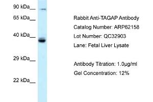 Western Blotting (WB) image for anti-T-Cell Activation rho GTPase-Activating Protein (TAGAP) (N-Term) antibody (ABIN2789039) (TAGAP Antikörper  (N-Term))