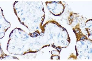 Immunohistochemistry of paraffin-embedded Human placenta using CSNK1A1 Polyclonal Antibody at dilution of 1:100 (40x lens). (CSNK1A1 Antikörper)