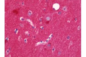 Anti-Alpha SNAP antibody IHC staining of human brain, cortex. (NAPA Antikörper  (AA 78-295))